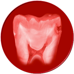 odontoiatria conservativa
